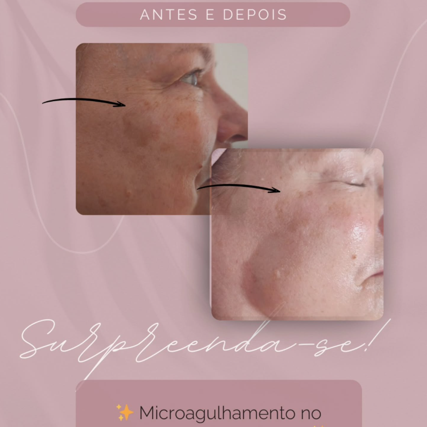 debora2